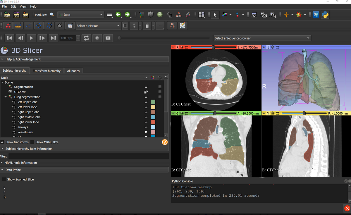 Medical Image Segmentation